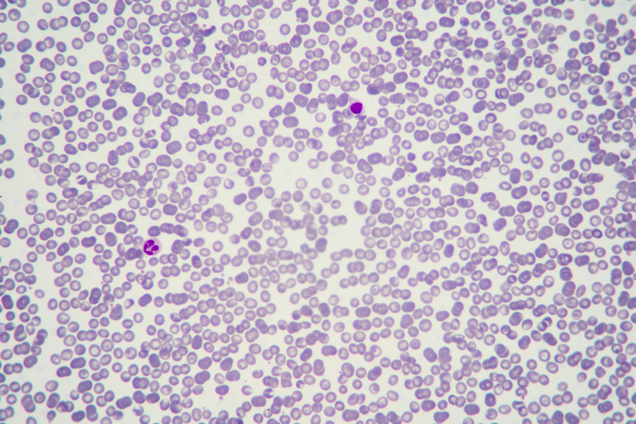 ¿Qué es un hemograma completo y qué información revela sobre tu salud?