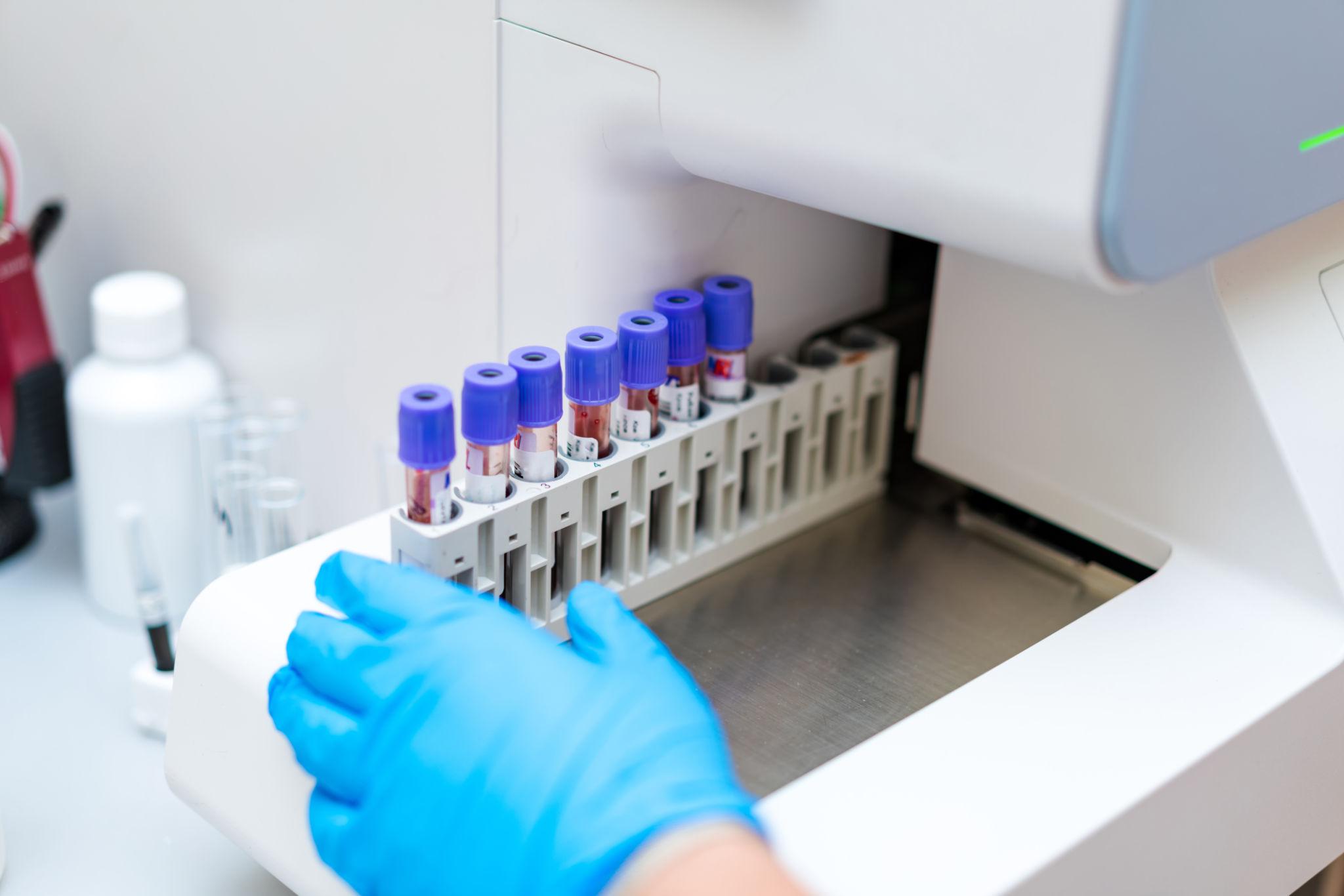 ¿Por qué es importante realizarse exámenes de laboratorio de forma periódica?